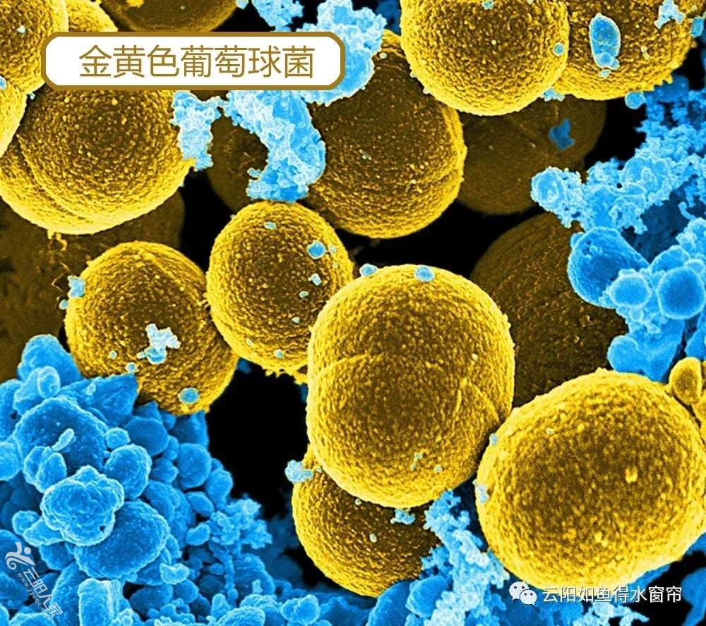 20220415033445front2_0_41610_FngsGAo_WqAzPkualYmseVd4iG1j.jpg