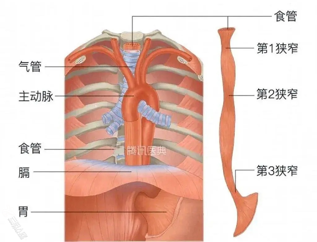 56.jpg